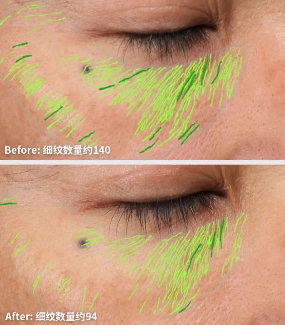 又便宜又好用的抗皱护肤品,30到40岁抗皱口碑最好的护肤品