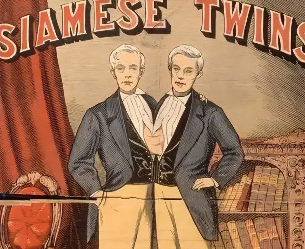 泰国连体兄弟娶美国姐妹,泰国连体兄弟娶双胞胎姐妹