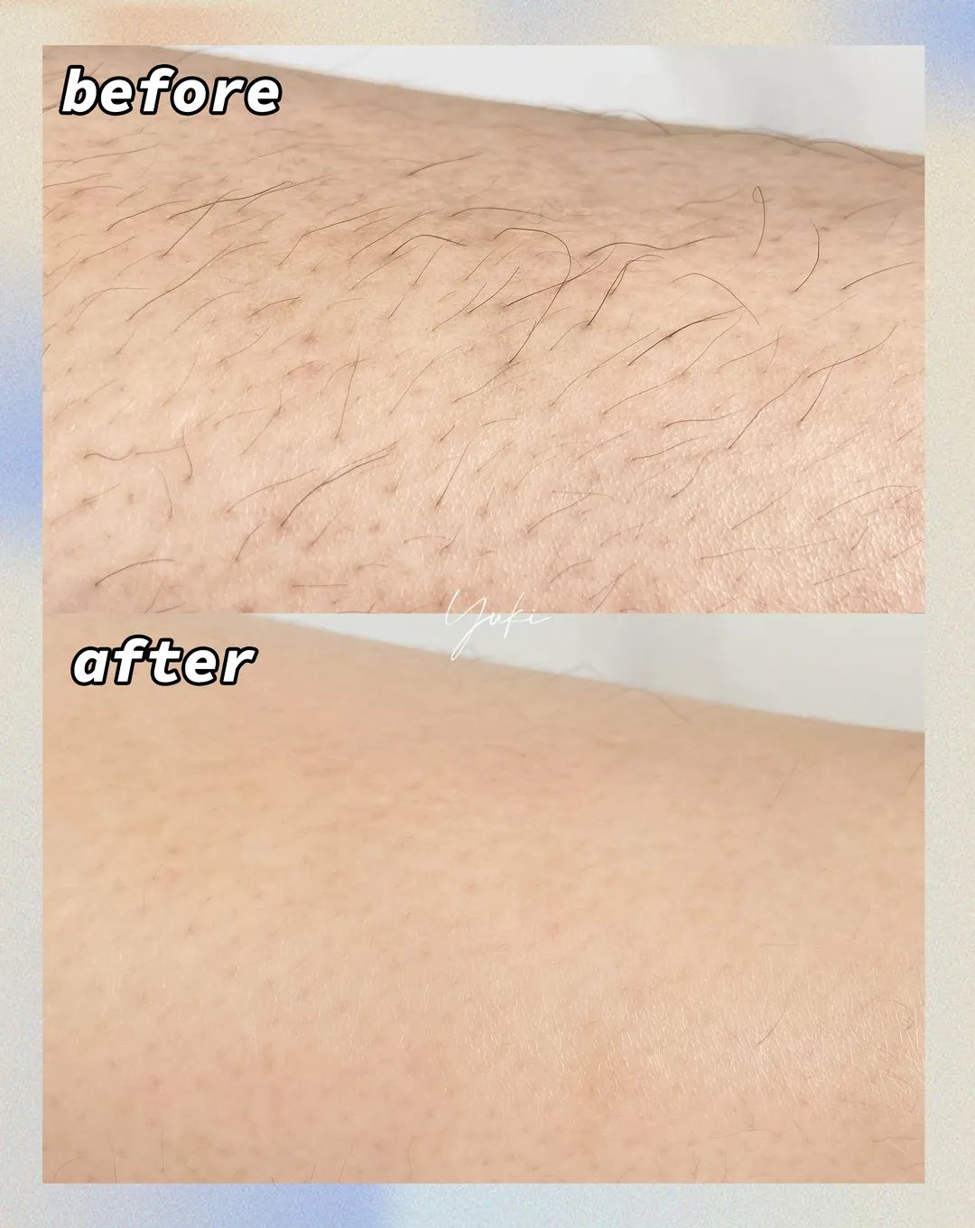 5款爆火脱毛产品真人实测!最便宜的居然是最好用?