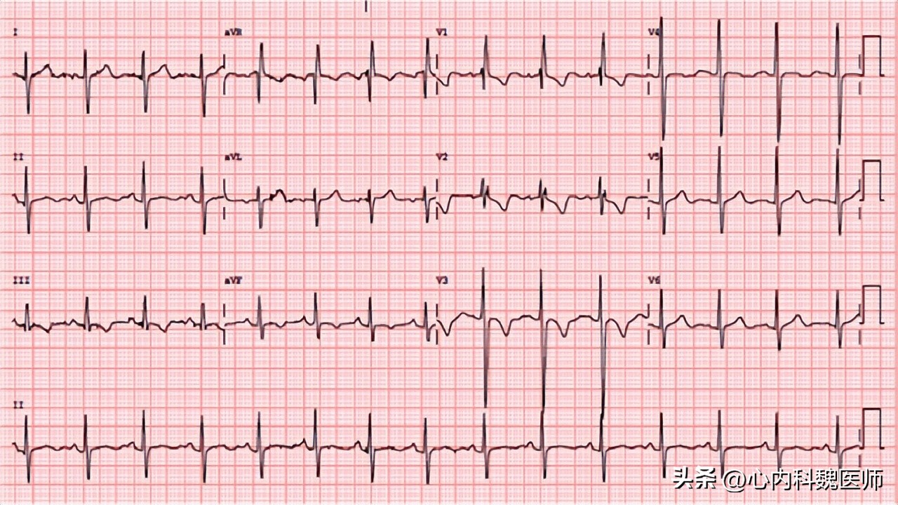 右乳房靠近胸口处刺痛是心脏病吗,为什么胸口会刺痛几秒是心脏病吗