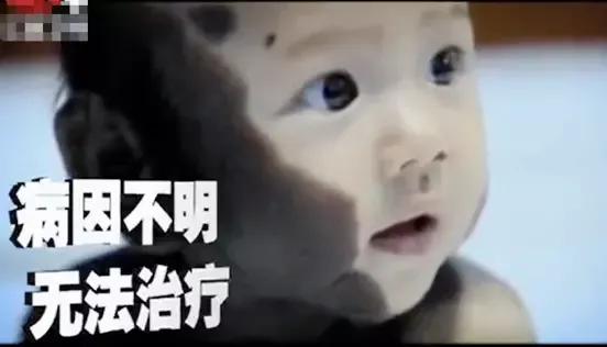 孕妇吃老鼠好不好,孕妇吃到老鼠孩子会怎么样