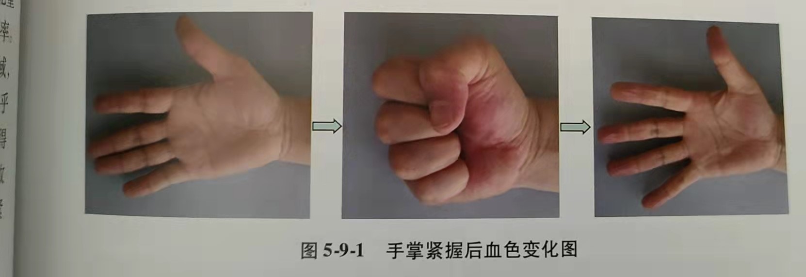 膝关节疼痛浮针疗法,浮针治疗疼痛手册pdf下载