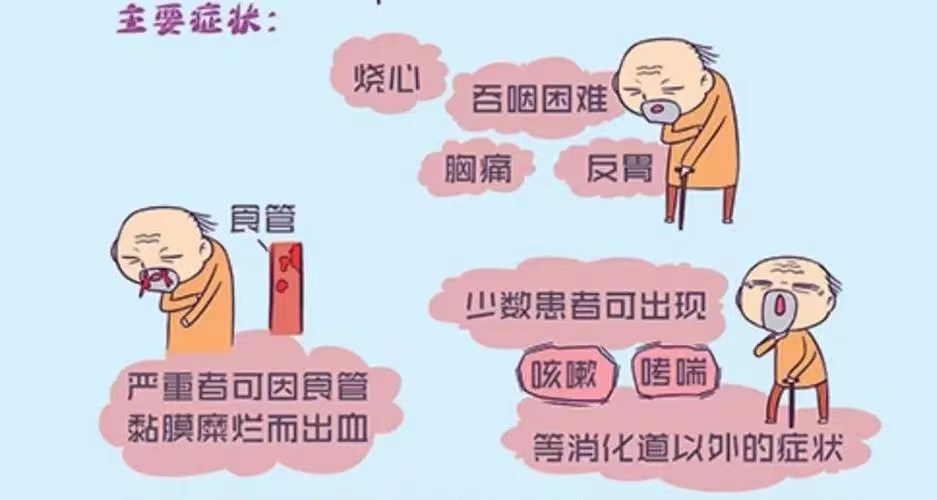 食管炎，消化科，新乡潘医生说消化道专业疾病