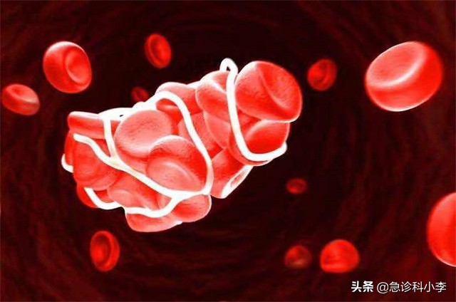 医生血脂化验单,医生一步一步教您看血脂化验单