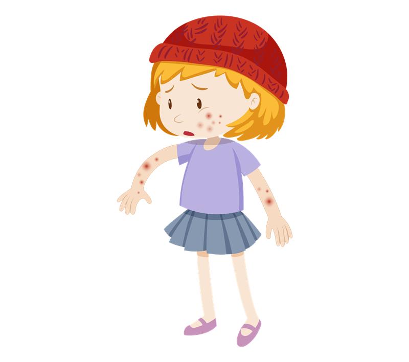 湿疹并不是“湿”出来的！关于湿疹，专家建议你了解这些