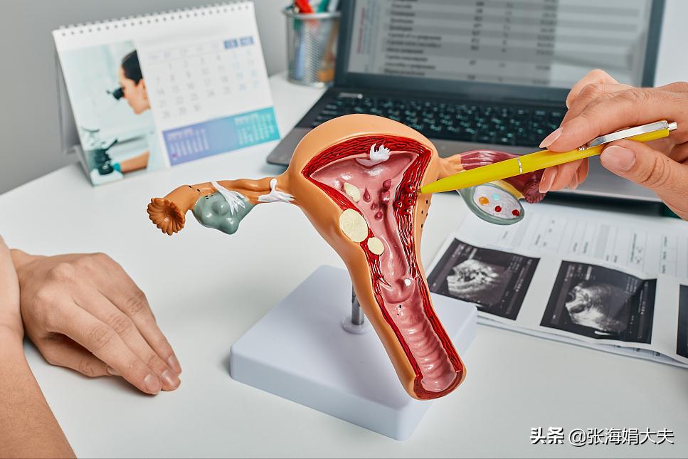 妇科疾病白带有血丝,白带有血丝警惕宫颈癌