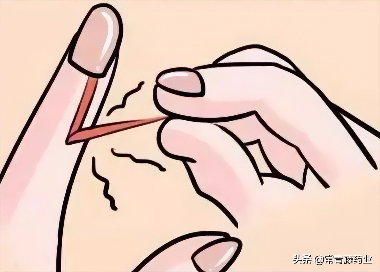 倒刺发炎痒,一直撕指甲怎么办