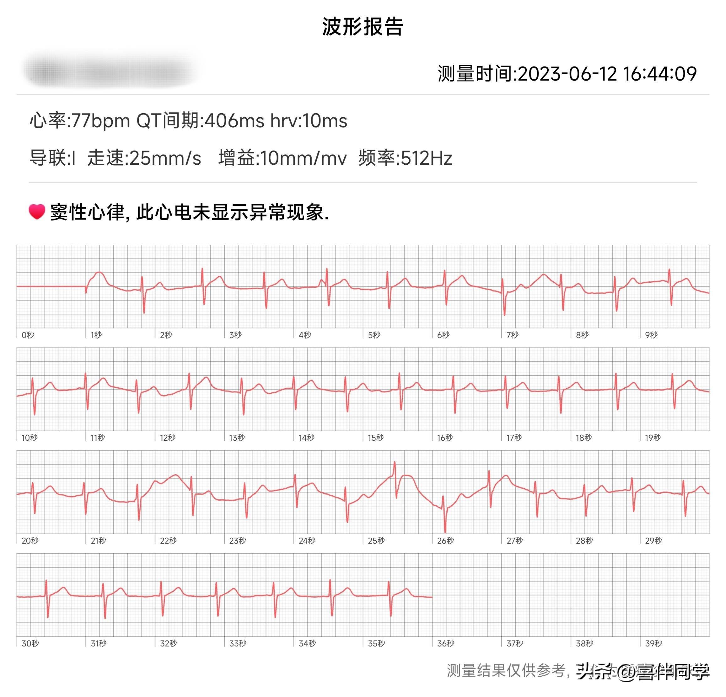 心电图血压手环测评,比较好能测血压的智能手环