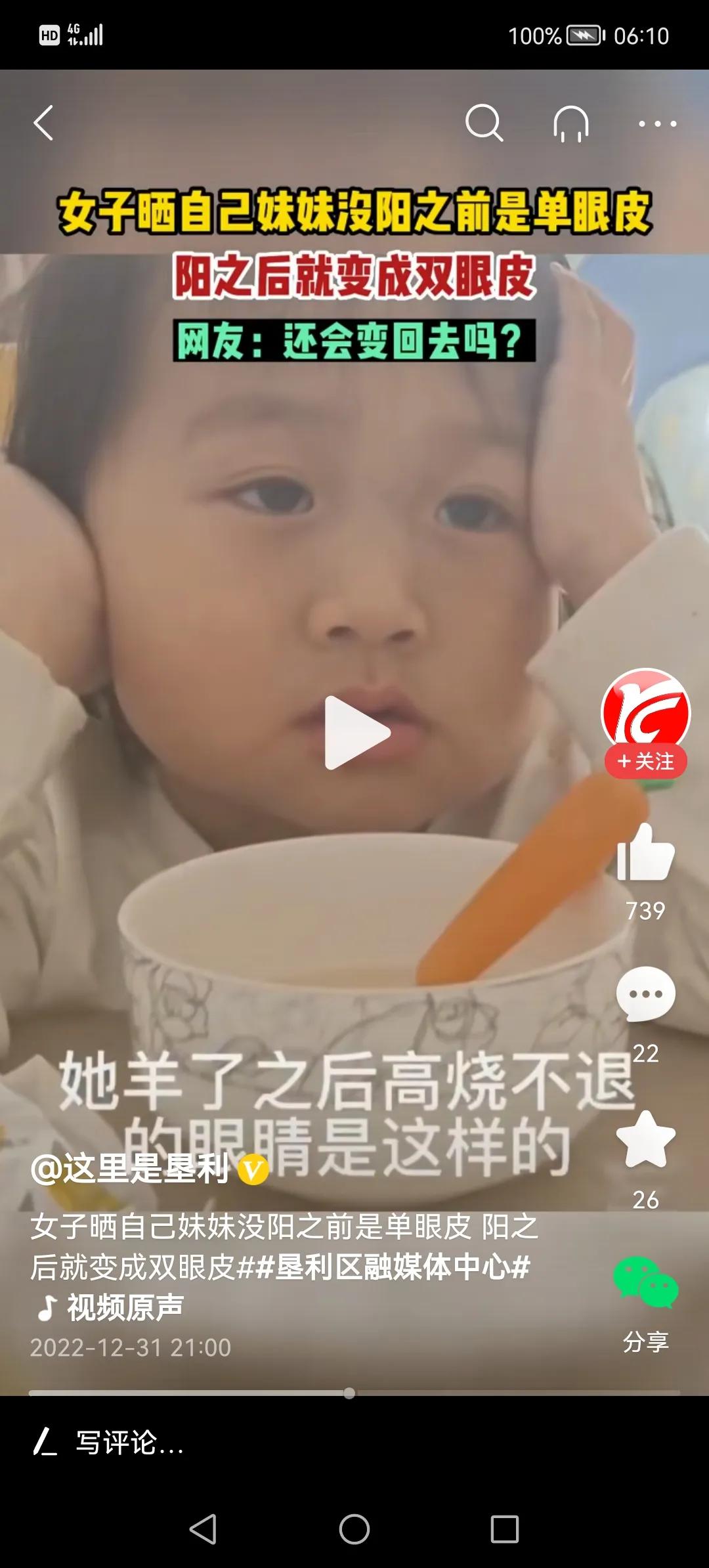小孩慢慢从单眼皮变成双眼皮,小孩一生病就变双眼皮怎么回事