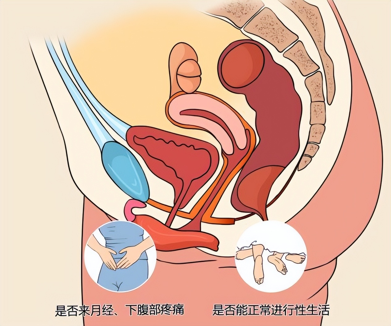 没有阴道的“石女”是怎么回事？还能过夫妻生活吗？答案让人心酸