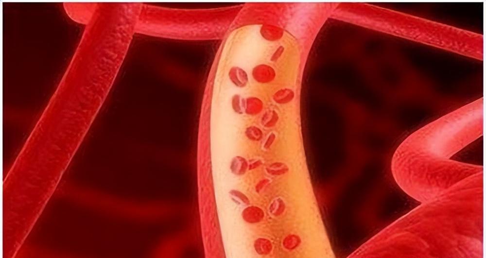 肛周脓肿用拔毒生肌散,肛周脓肿中医方剂