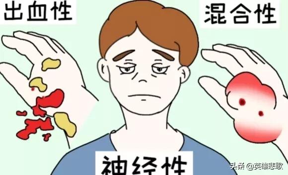 莽山烙铁头17.7公斤是真的吗,莽山烙铁头5000一条是真的吗