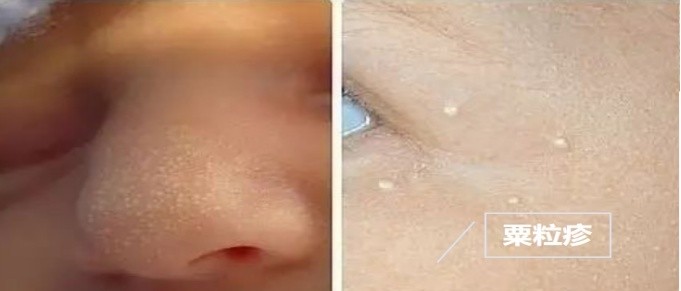 月嫂照顾产妇护理程序,新生儿养育护理常识