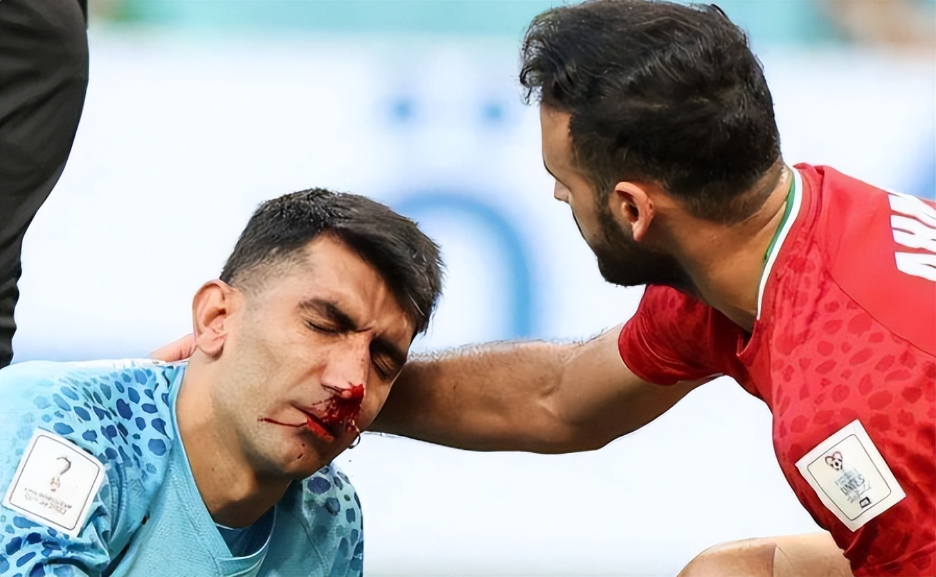 运动后鼻子出血的原因,运动后鼻子不舒服怎么办