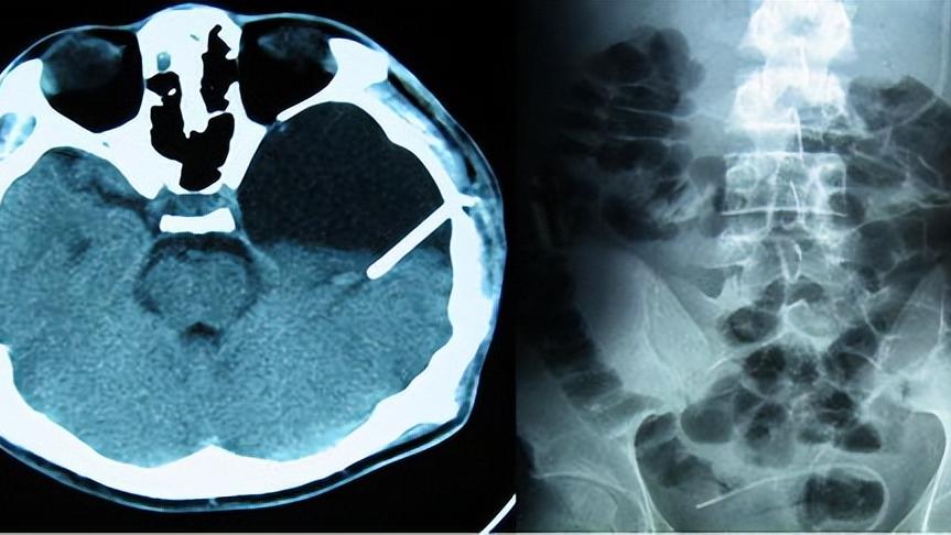 小孩检查脑ct有危害吗,年龄大了查血查什么好
