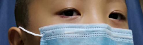 分享配眼镜案例,分享配眼镜的小知识