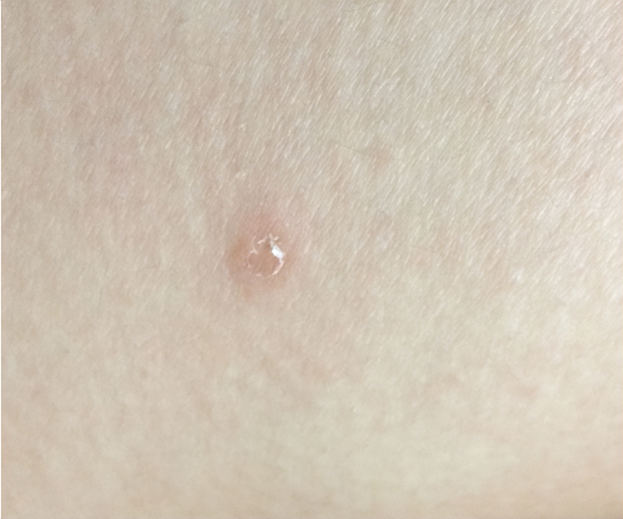 怎么在*生活性**前，判断对象有没有性病？