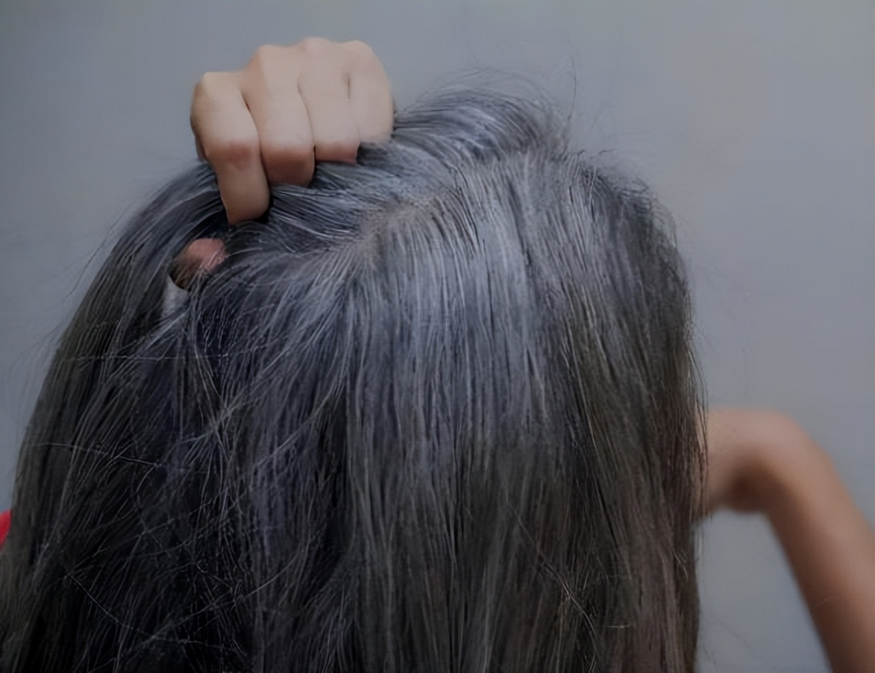 白头发越来越多是什么原因27岁,白头发越来越多是什么原因24岁