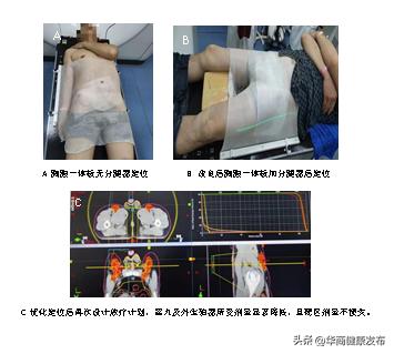 男子得了罕见怪病,男子罕见怪病