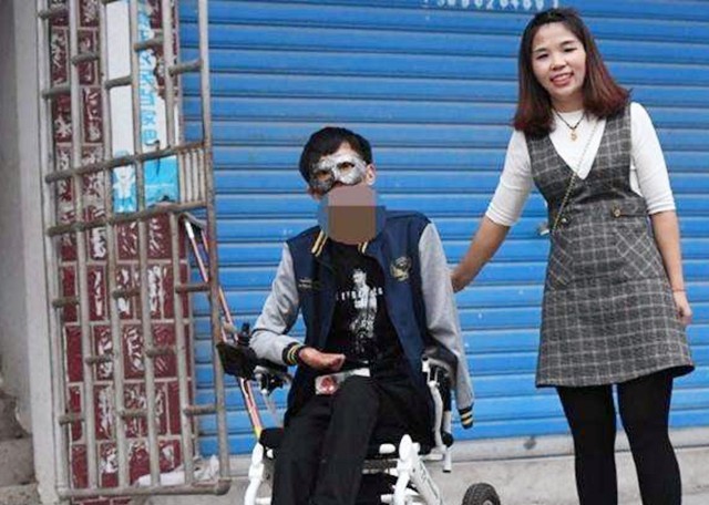 新郎救火时毁容新娘依然嫁给了他,新郎被烧伤新娘前往医院