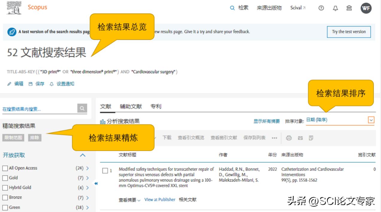 如何使用scopus检索,在scopus中查看引用文献