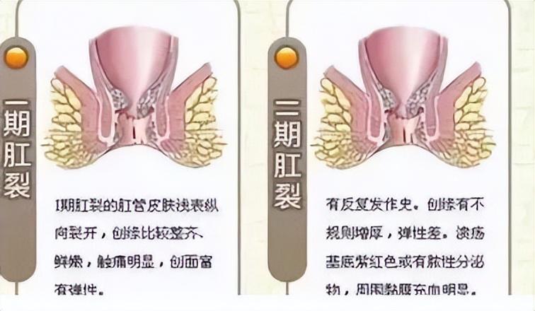 你有洗屁股的习惯吗,你有洗屁屁的习惯吗