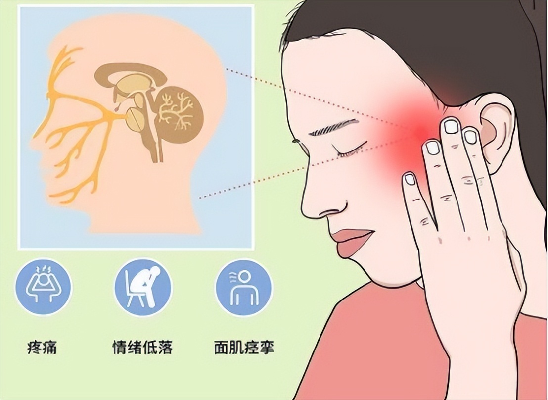 三叉神经痛伽玛刀可以维持多久,三叉神经痛伽玛刀有哪些副作用