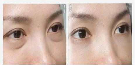 九院面部年轻化有哪些项目,40岁做什么医美项目可以提升脸部