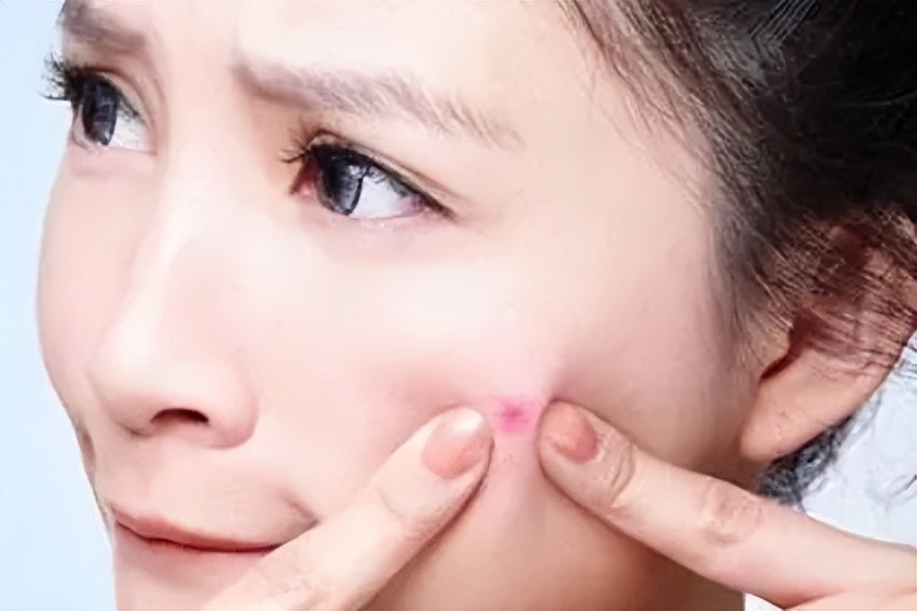 葛林若皮肤管理知识,葛林若护肤顺序