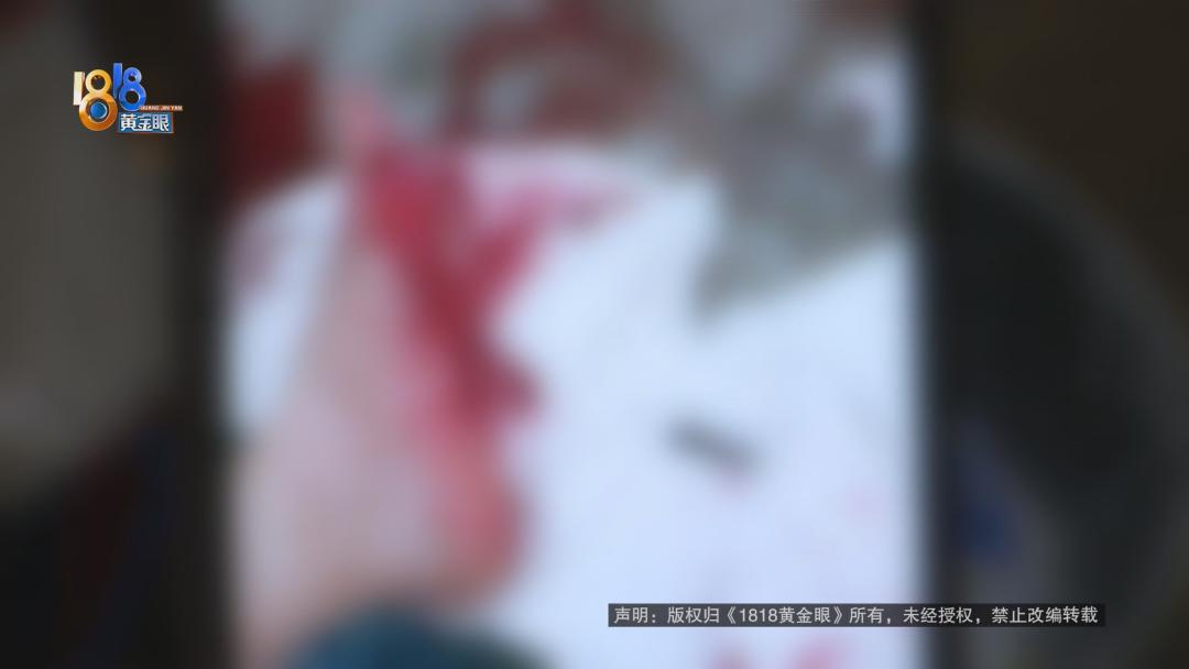 出差入住浴场，拐杖买了两次