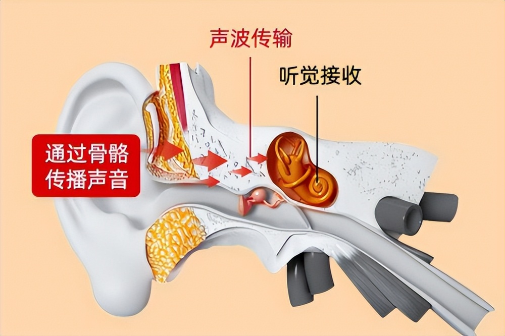 骨传导耳机黑码科技,韶音骨传导耳机年销售量