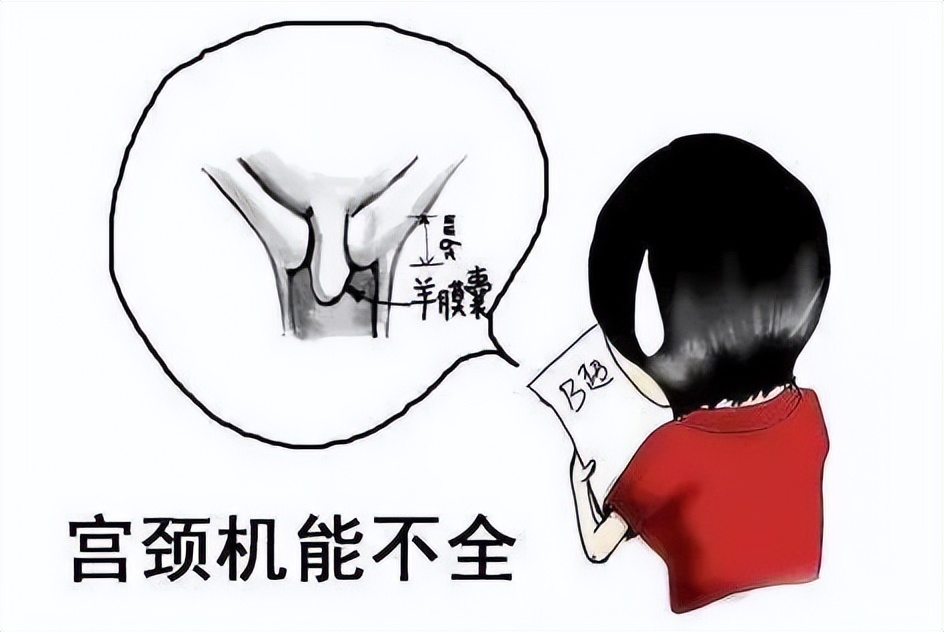 高孕周行腹腔镜下子宫颈环扎术她终于圆了母亲梦