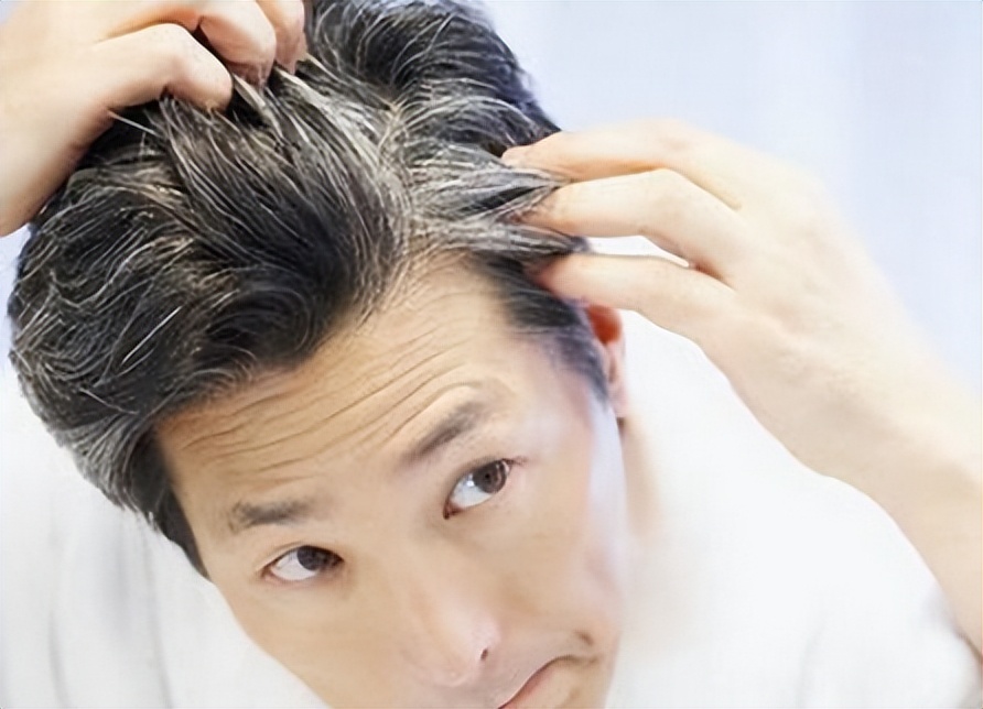 前额和鬓角白发是什么原因,两鬓和后脑勺长白发是什么原因