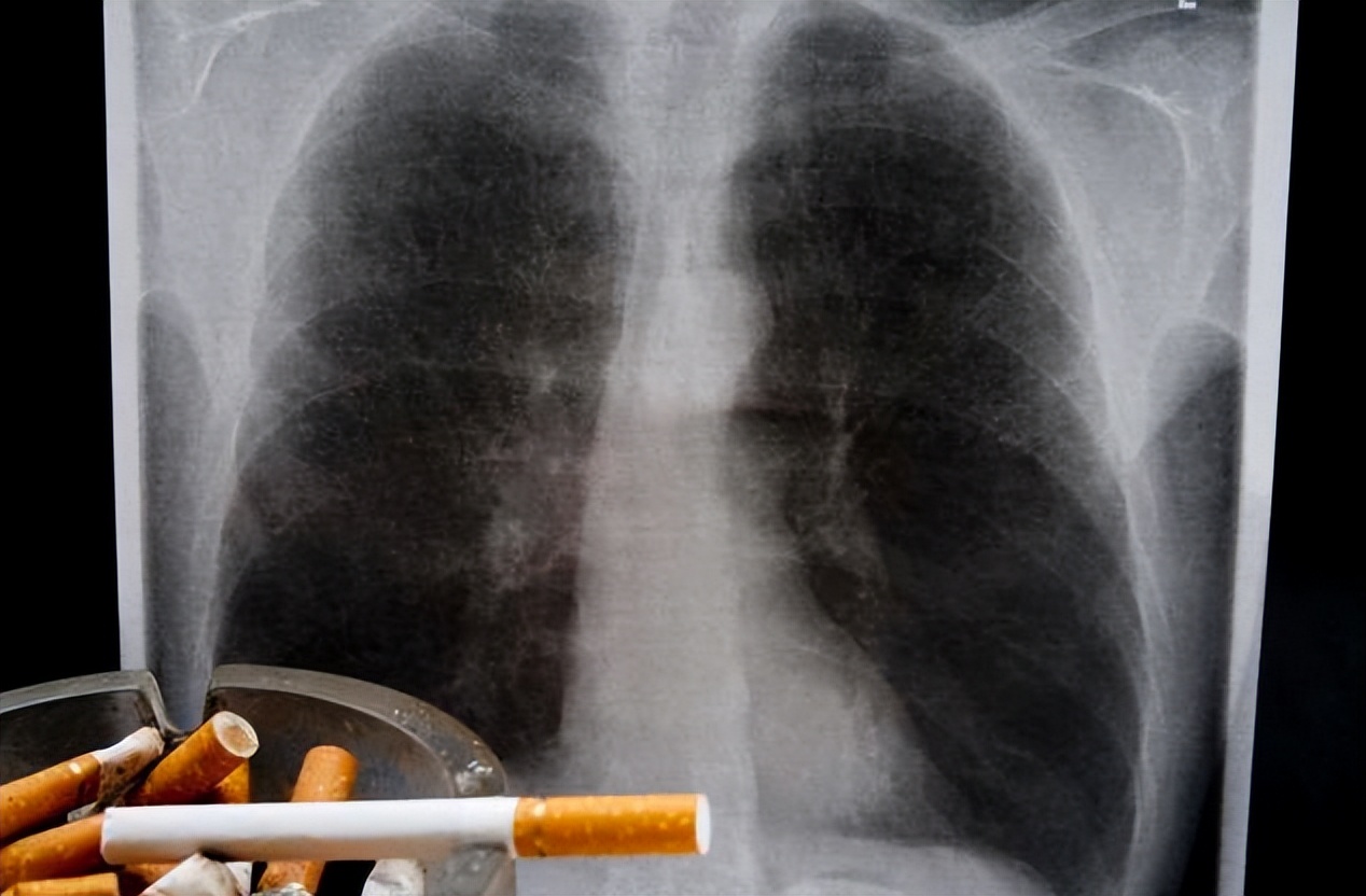 吸烟时4个习惯更伤肺,吸烟的人停止吸烟后肺有什么变化