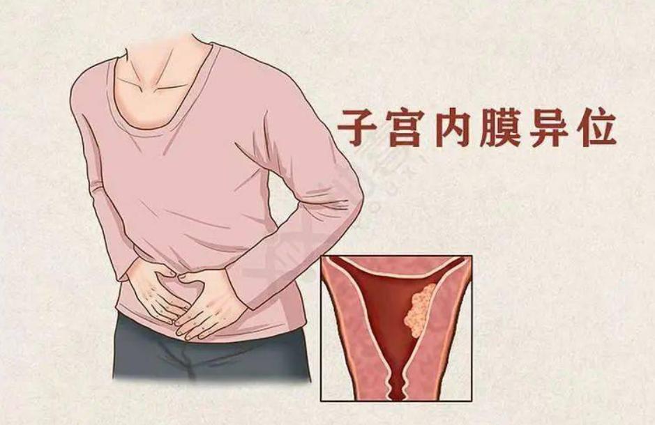 没有性的生活需要检查hpv吗,需不需要定期做妇科检查