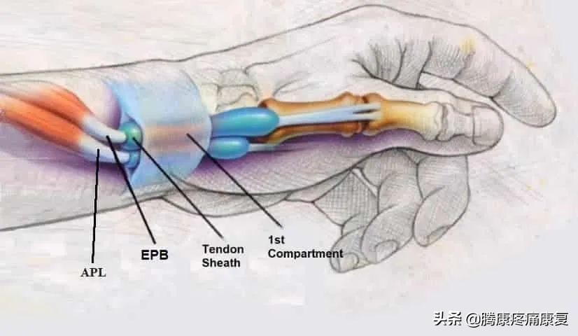 前臂桡侧疼痛怎么缓解,前臂疼痛按摩如何缓解