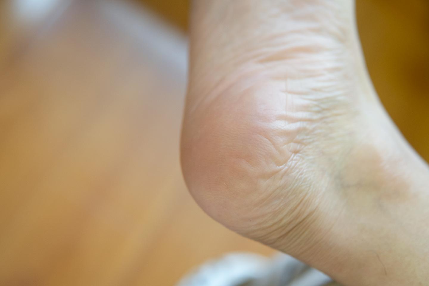 有了它终于不用当抠脚大汉了——DOCO电动修足器