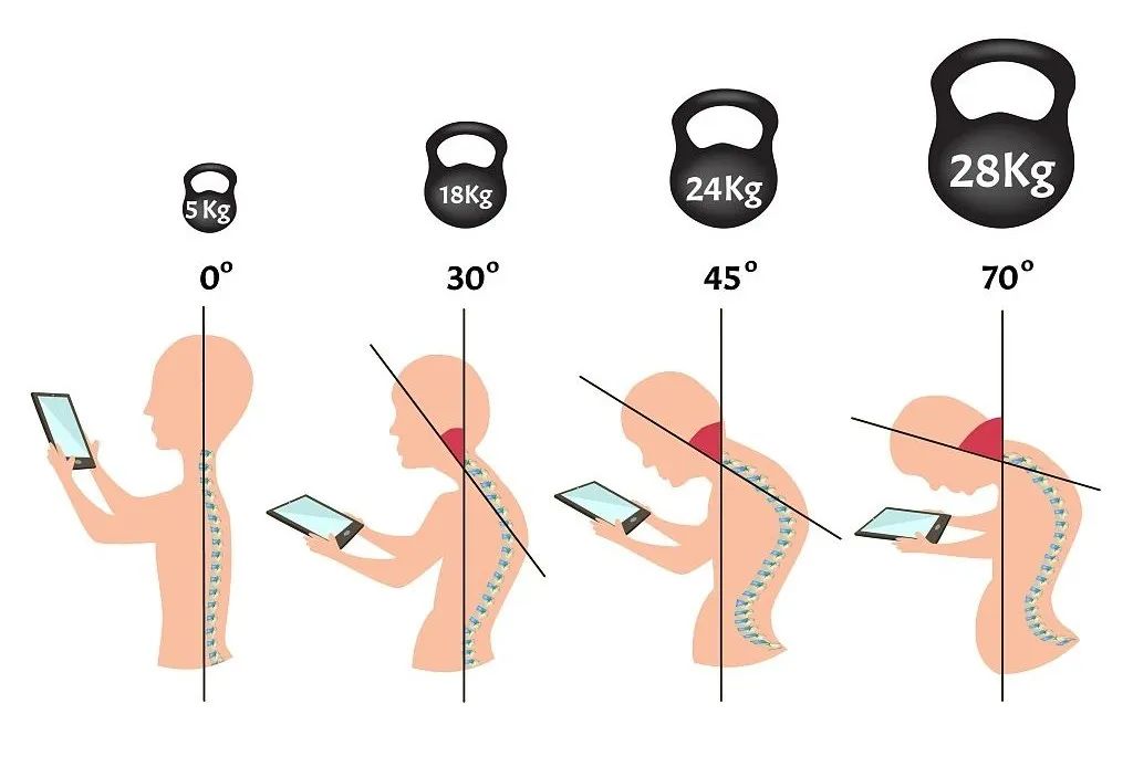 颈椎疼痛的自救指南,颈椎疼痛一招解决太神奇了
