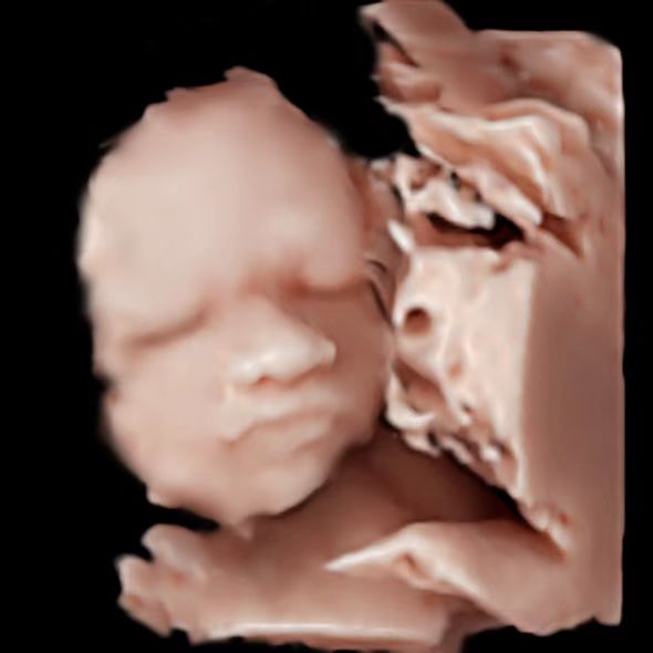 客户故事|坚韧和理性成就的母性之光