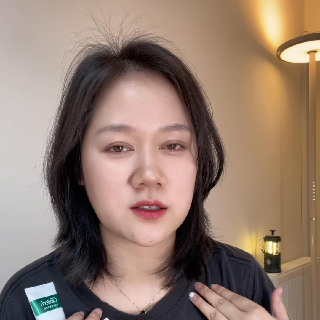 头油头皮有油脂颗粒,头油头上起疙瘩头发白头皮屑多