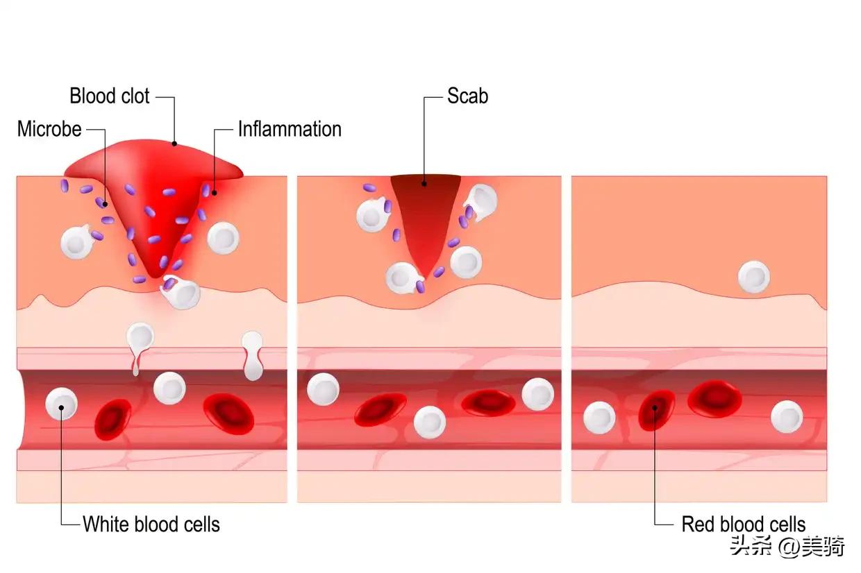 汽车事故处理的7个技巧,一般骑车摔伤怎么处理伤口