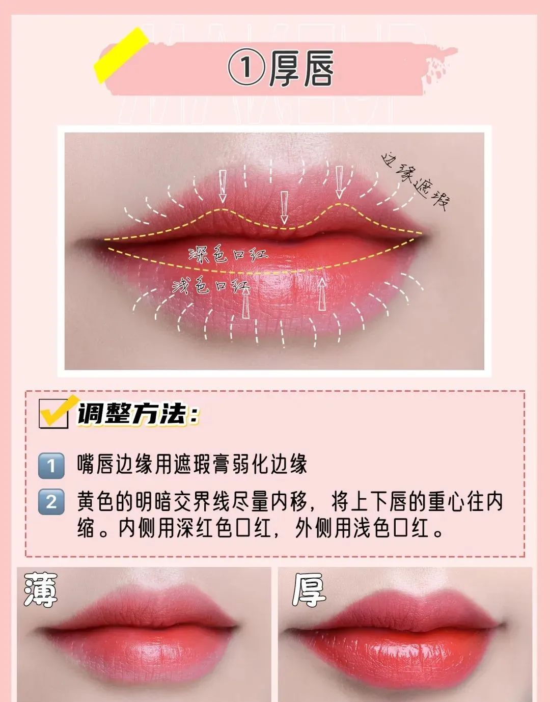 唇形改善案例,唇形变美干货