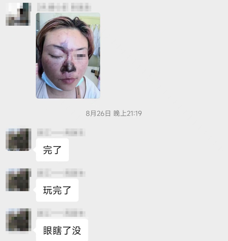 玻尿酸栓塞几个小时内出现问题,栓塞玻尿酸栓塞的概率高吗
