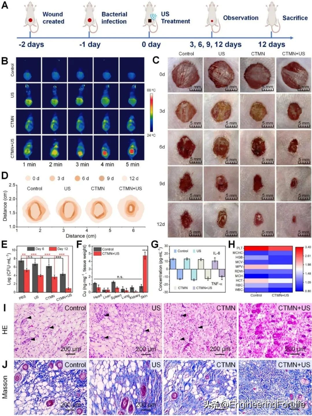 《ActaBiomater.》:超声激活微针用于声温抗菌治疗