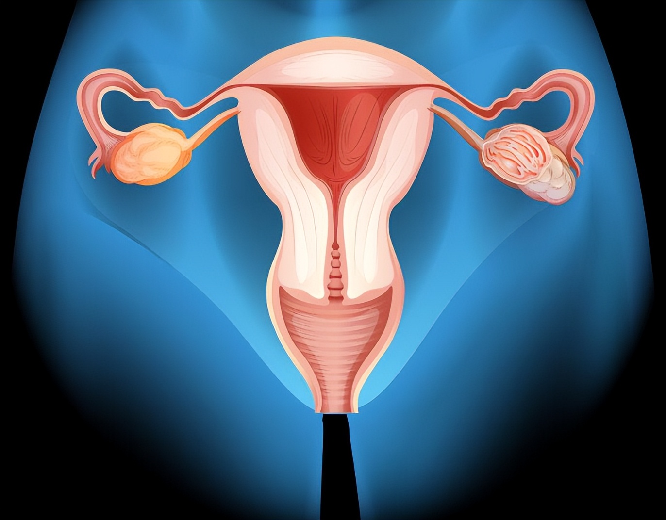 为什么会发生阴道痉挛？对女性身体影响大吗？需不需要治疗？