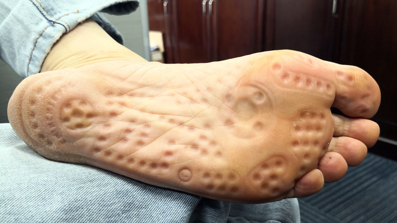 按摩袜真的有效吗,足疗袜靠谱吗