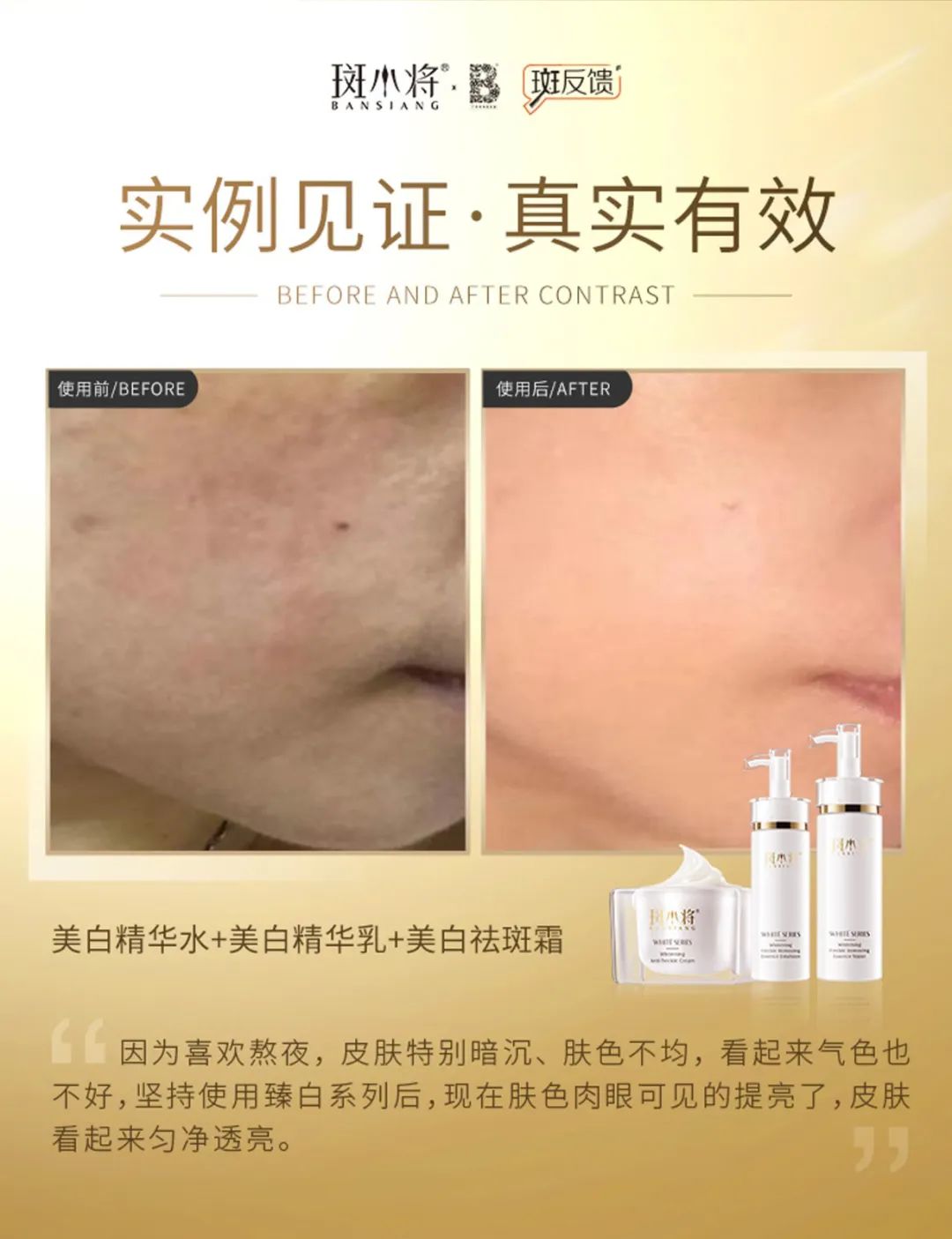斑小将祛斑一套多少钱,斑小将产品真的能祛斑吗
