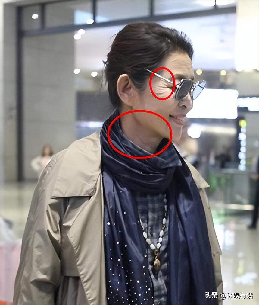 面部衰老皱纹图,面部衰老皱纹解剖图