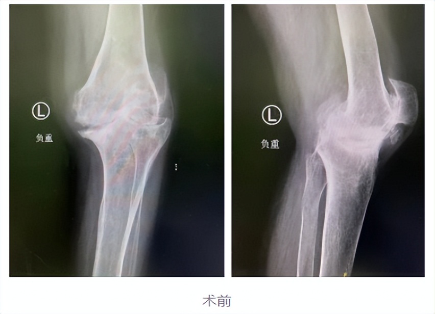不死的癌症指的是哪种症状,不死的癌症有多可怕