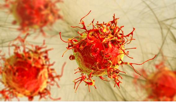 外阴癌前病变患者注意事项,得了早期外阴癌怎么办